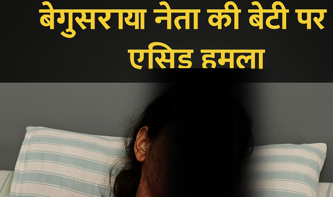 बेगूसराय में भाजपा नेता की बेटी पर एसिड हमला